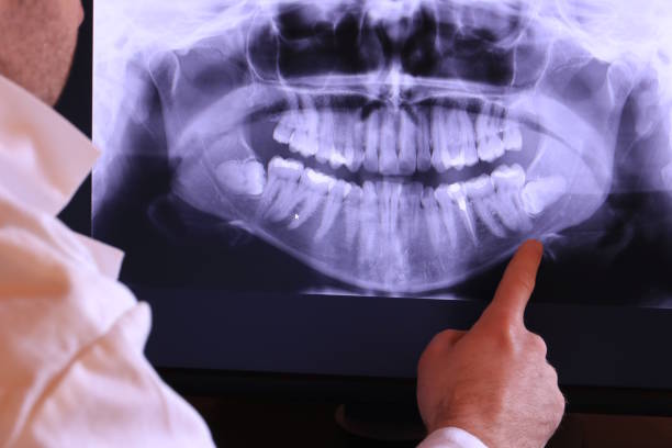 Best Cosmetic Emergency Dentistry in Belmont, NC