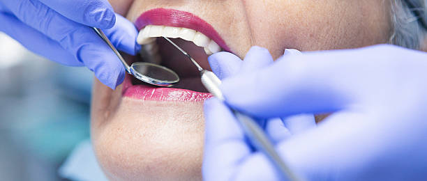 Best Emergency Dental Care for Broken or Chipped Teeth in Belmont, NC